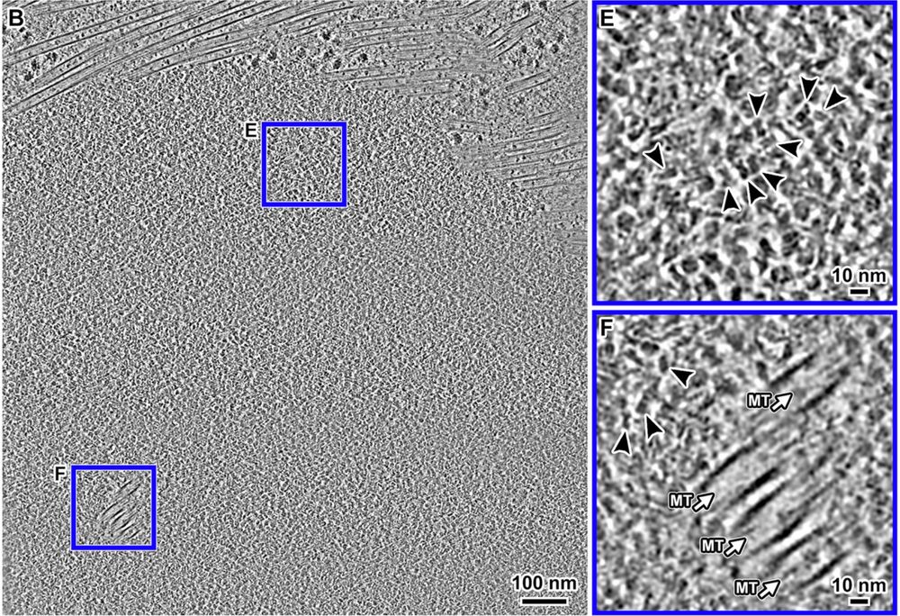 Cryotomograms of a metaphase RPE-1 cell.