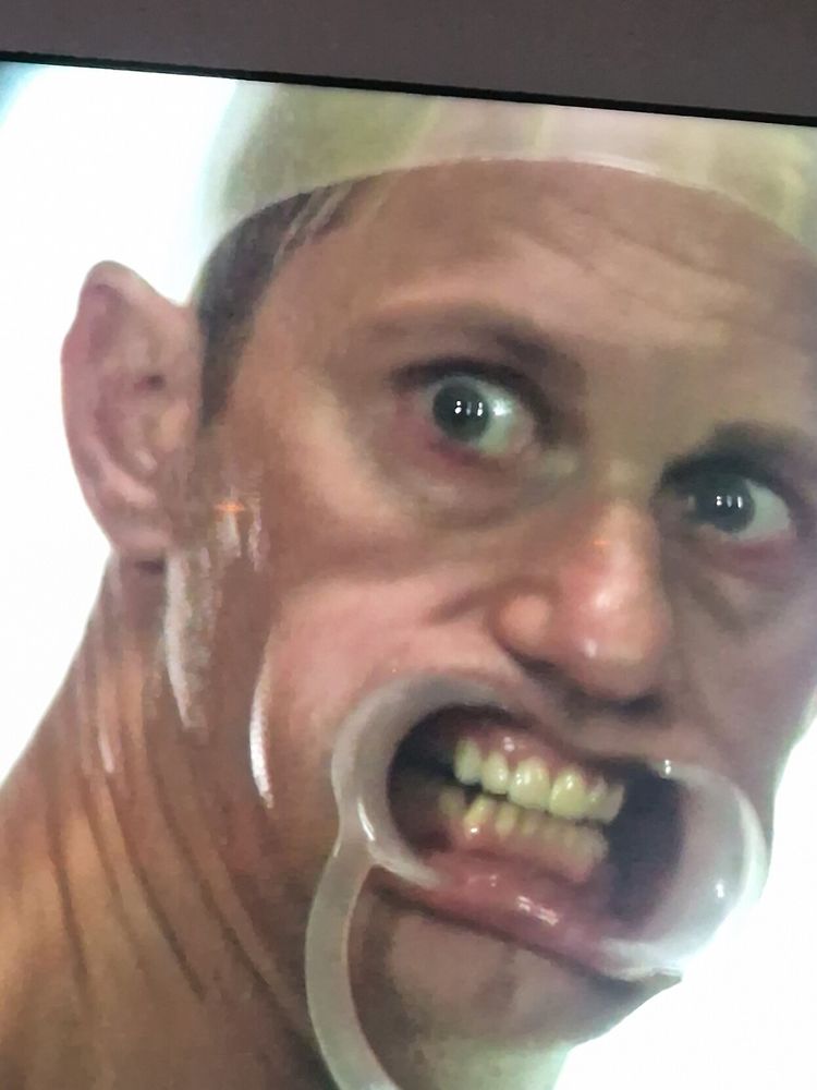 A still of Alexander Skarsgård in Infinity Pool with a headcap and speculum type thing in his mouth. He look like Wallace from Wallace and Gromit.