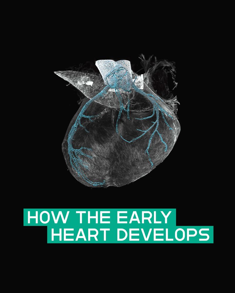 Image with text: The image features a detailed black-and-white scan of a developing heart on a solid black background. Thin blue lines highlight the early vascular structure.

Explanation of scientific image: In this image taken during a late embryonic stage of a mouse heart, the developing coronary arteries have been stained turquoise using antibodies. The tissue was made transparent using tissue clearing and the image was taken using a light sheet microscope. 

The overlaid text reads “HOW THE EARLY HEART DEVELOPS” in all-caps white sans-serif font, placed within a green rectangular background near the bottom of the image. 