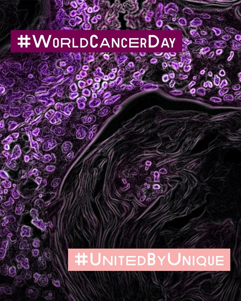 A microscopic image of cancer cells in shades of purple, overlaid with two hashtag boxes: #WorldCancerDay written in white letters on a dark magenta text box at the top, #UnitedByUnique in a light pink box at the bottom.