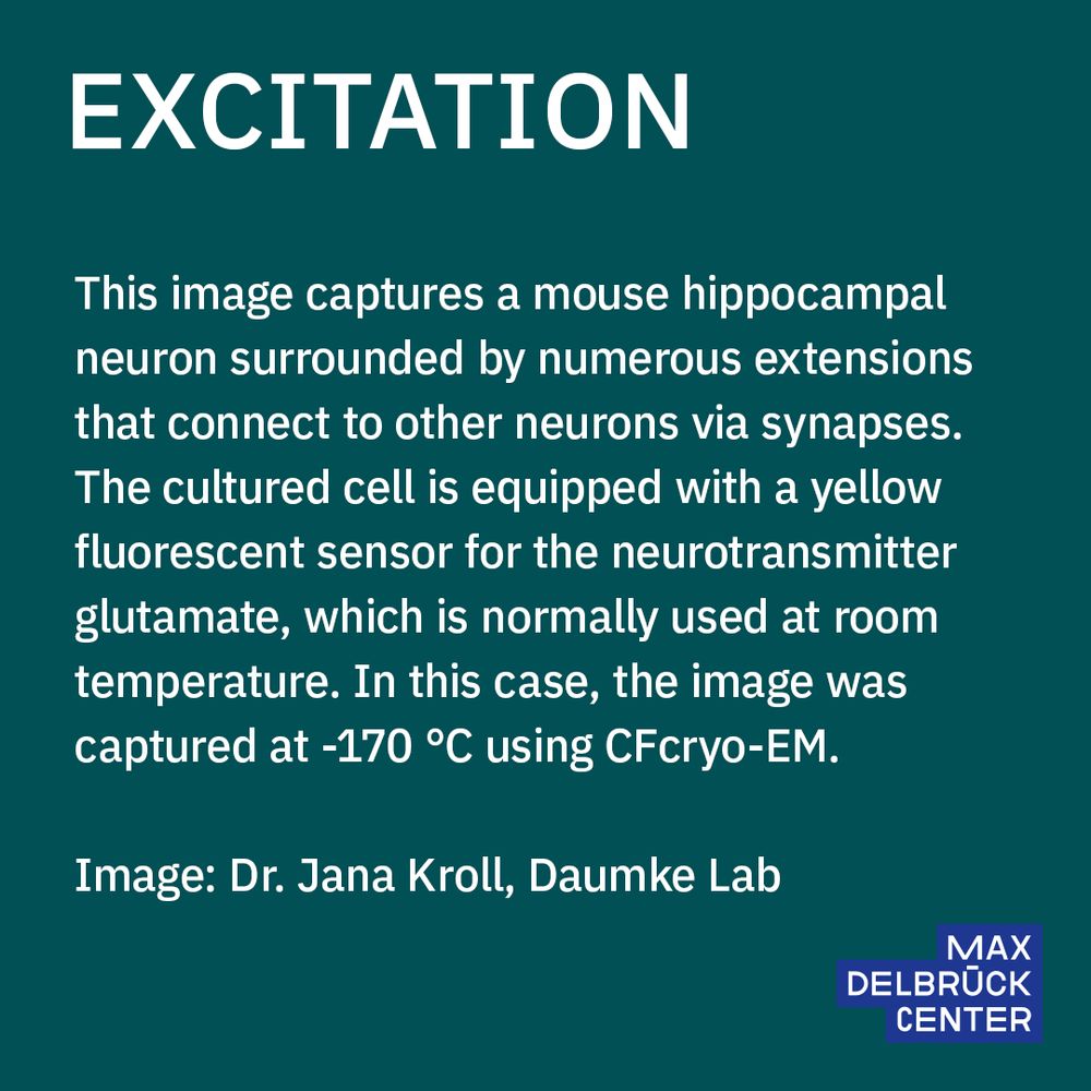Excitation 
This image captures a mouse hippocampal neuron surrounded by numerous extensions that connect to other neurons via synapses. The cultured cell is equipped with a yellow fluorescent sensor for the neurotransmitter glutamate, which is normally used at room temperature. In this case, the image was captured at -170 °C using CFcryo-EM (Core Facility for Cryo–Electron Microscopy).
Image: Dr. Jana Kroll, Daumke Lab