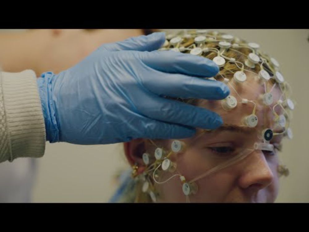 Advancing Brain Research: The Frohlich Lab's Work in Neurostimulation and Mental Health