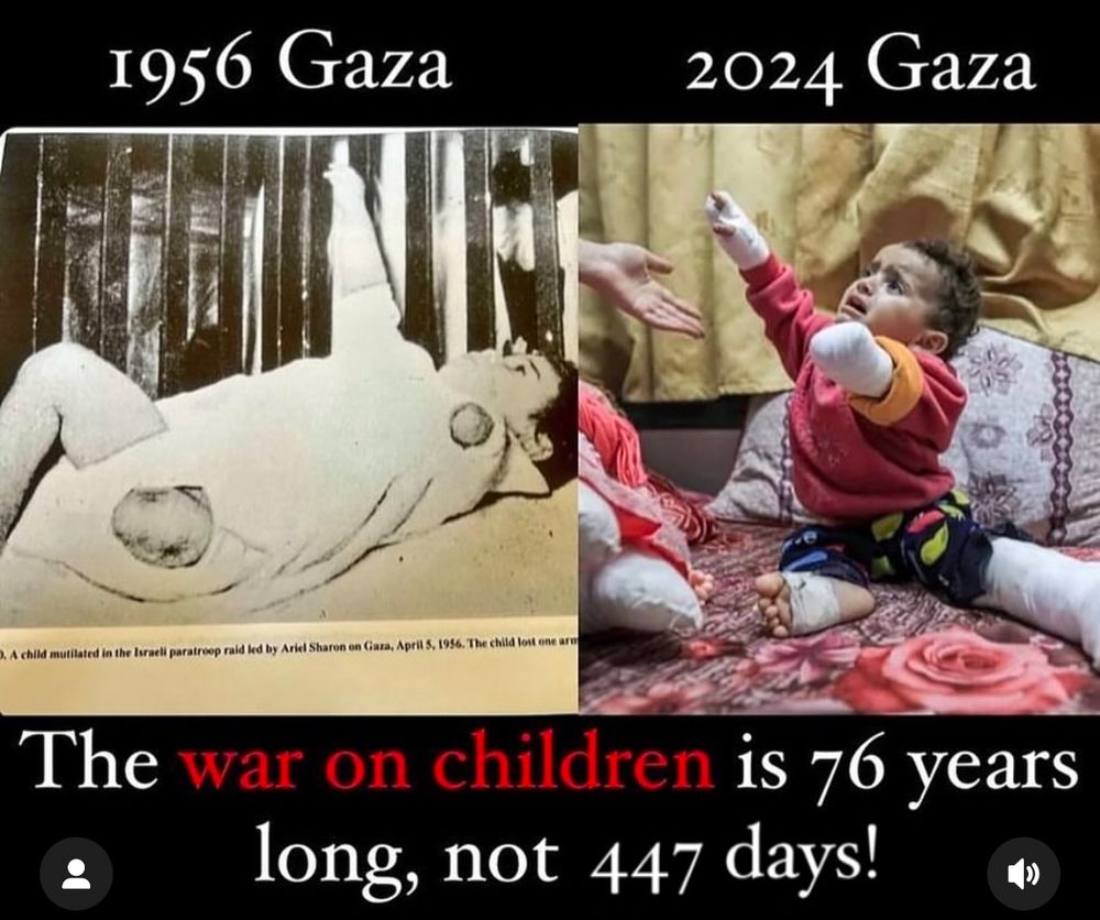 Two photos showing babies with limbs amputated. Children of Gaza - one from 1956 and one from 2024. 