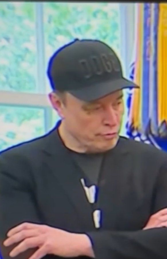Elon Musk with a bruise under his right eye.