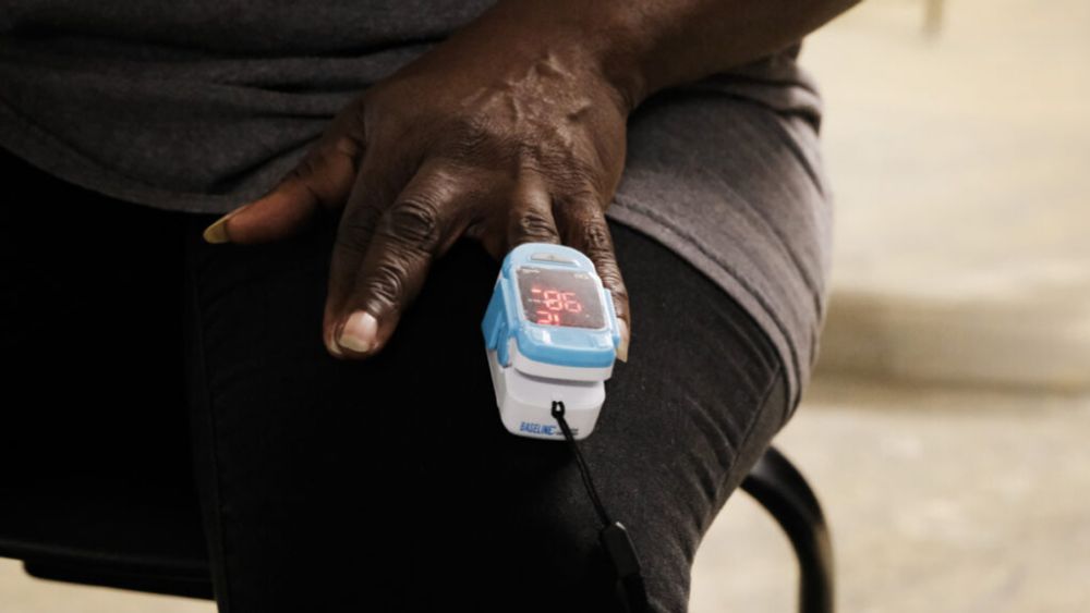 FDA misses target date for releasing rules to make pulse oximeters more equitable