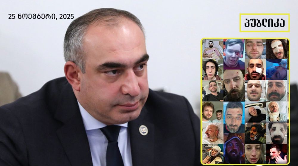 Photo of Lado Bozhadze , a leegitimate MP of Georgian Dream who keep lying that no protesters were beaten or tortured.