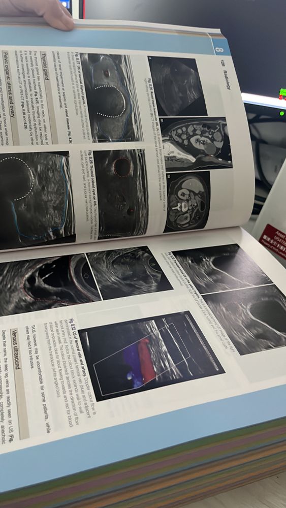 Inside view of the chapter. Lots of well annotated imaging to accompany the text explaining different modality of imaging and its uses. 