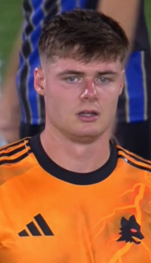 Evan Ferguson sporting the kind of sunburned nose you’d see coming off Laytown strand in August.  