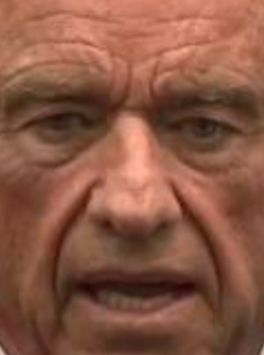 Heavily cropped photo of RFK's head