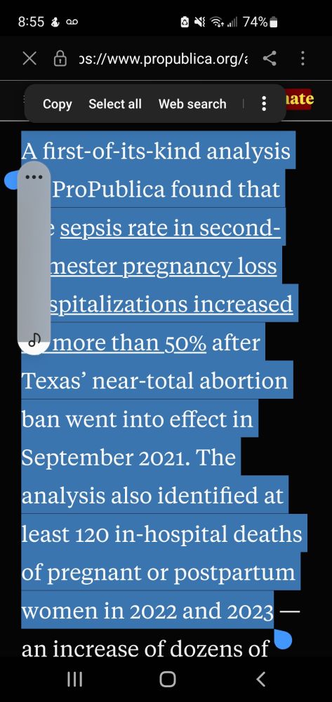 A first-of-its-kind analysis by ProPublica found that the sepsis rate in second-trimester pregnancy loss hospitalizations increased by more than 50% after Texas’ near-total abortion ban went into effect in September 2021. The analysis also identified at least 120 in-hospital deaths of pregnant or postpartum women in 2022 and 2023