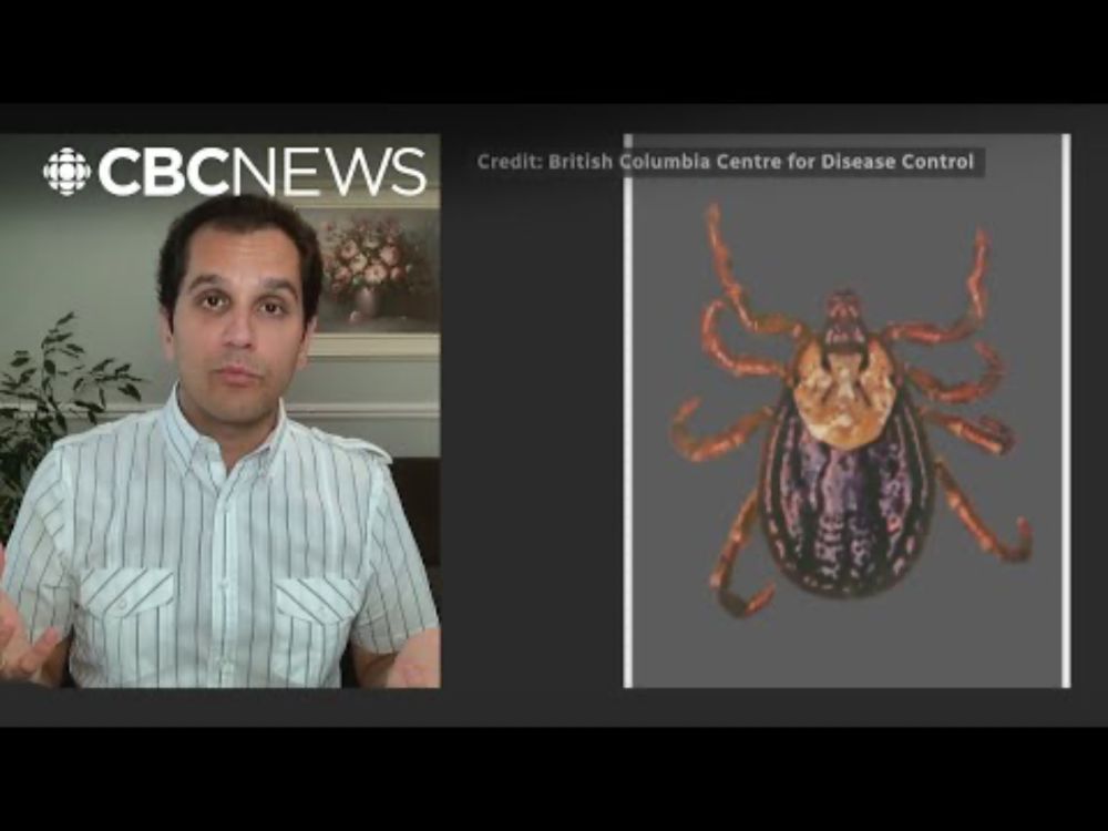 Tick-borne diseases on rise due to warmer temperatures, experts say