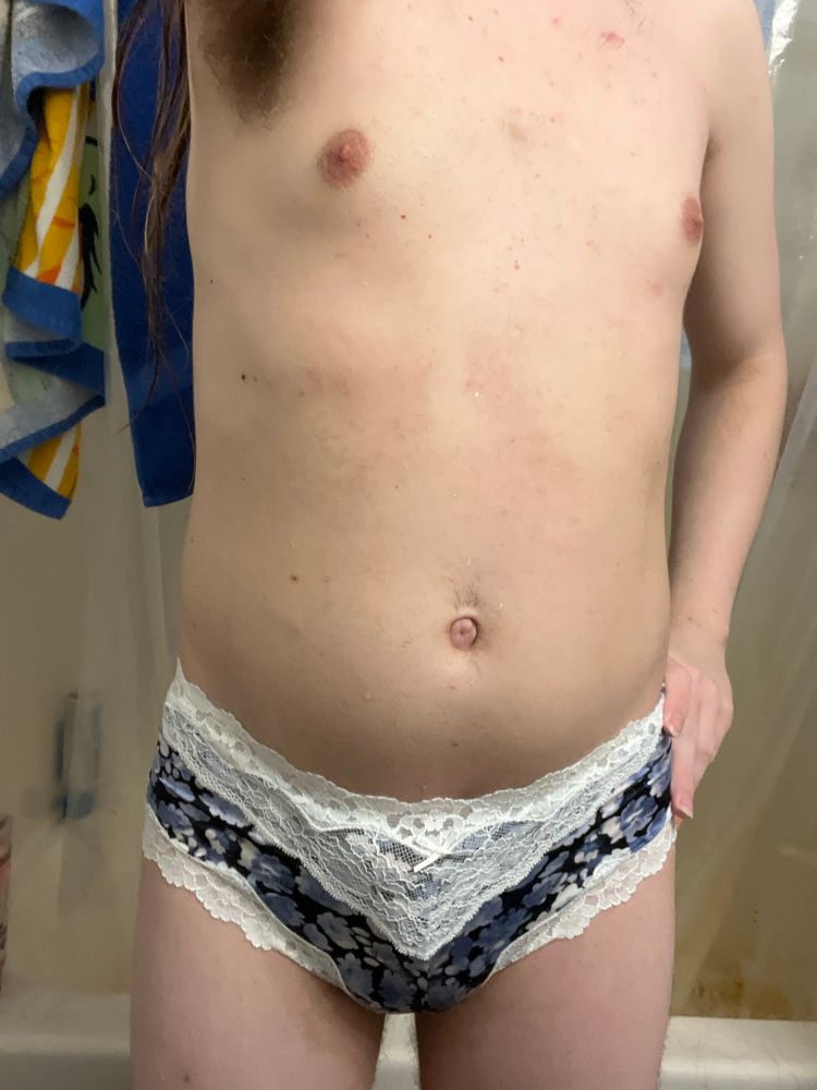 I would call these Captain Sapphire’s; white lace with blue. I think they have a white floral pattern. I am topless, and shaved all the parts of my that are in the photo. 

Minimal girl bulge visible, but still visible. 