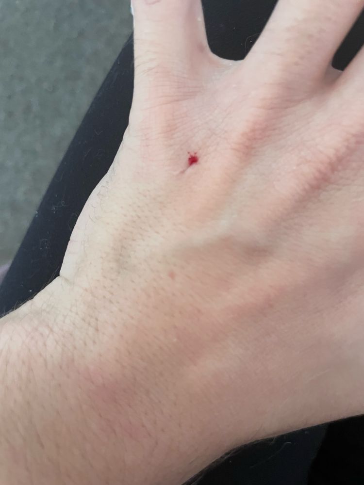 blood dot from claw on hand
