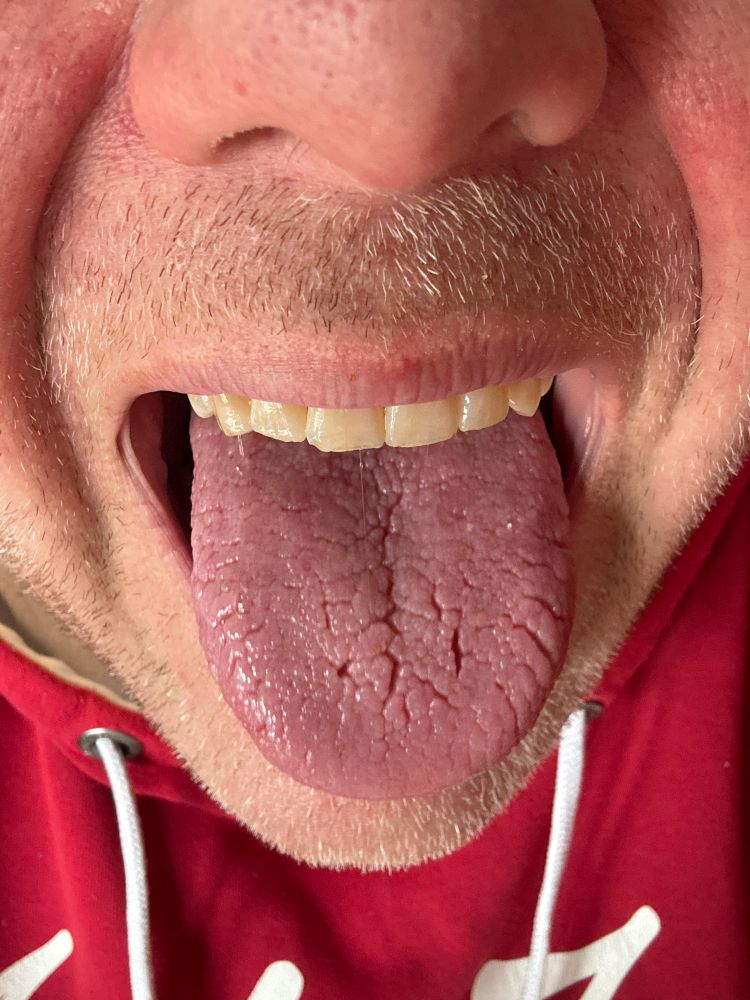 Comment image
