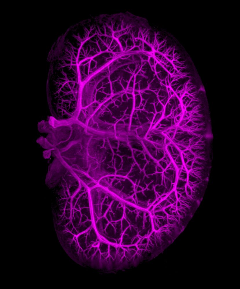 Image captured by a light-sheet microscope showing the arterial tree of an adult mouse kidney in magenta