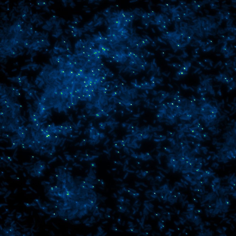 Bright green spots are phages (viruses), bacteria are the faint rods in light blue.
