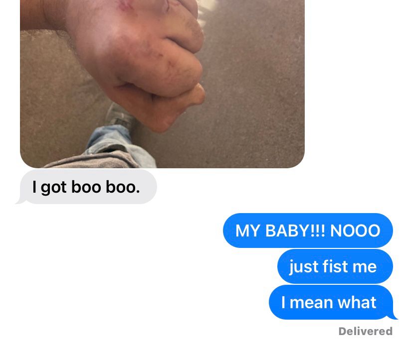 A screenshot of messages between Angel and her partner. Her partner sends a picture of his hand with a bruise and “I got a boo boo” Angel replies “MY BABY!!! NOOO. just fist me. I mean what” 