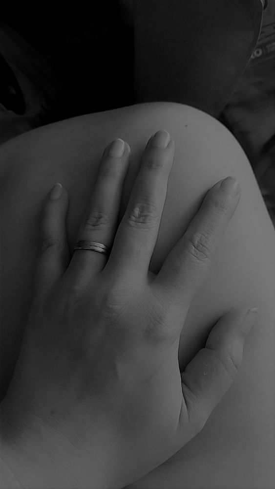 Schwarzweißaufnahme meiner linken Hand auf meinem nackten Knie, mit einem Ring am Ringfinger. 