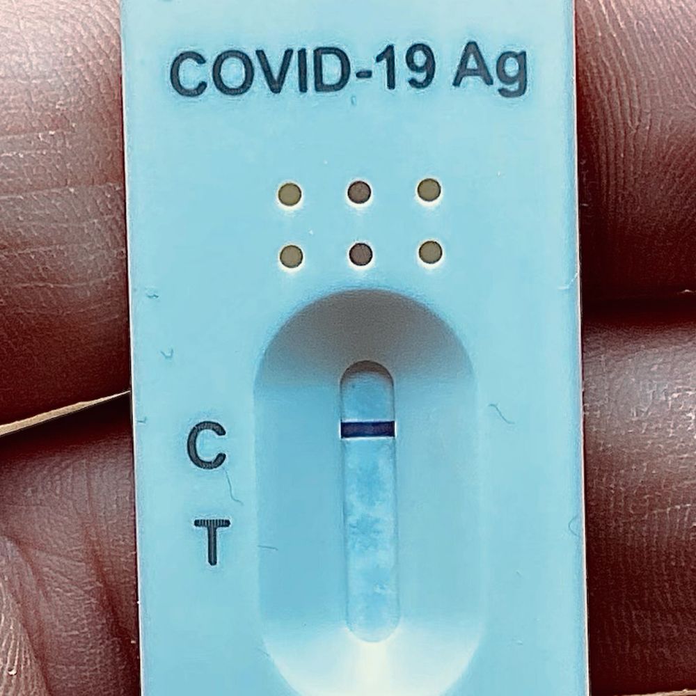 Close up picture of a negative corona test.