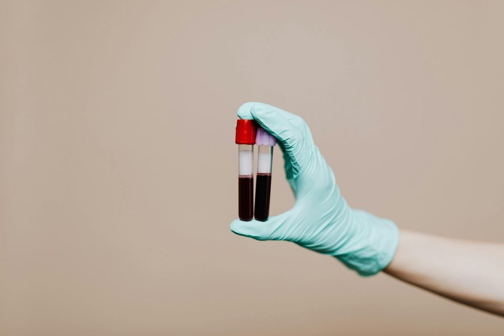 Uma nova pesquisa em ratos, cujos resultados foram publicados na revista científica Cell Metabolism, sugere que um suplemento de proteína para retardar o envelhecimento e melhorar a saúde pode um dia estar disponível para humanos. Entre aqueles que buscam o equivalente científico da "fonte da juventude", acredita-se amplamente que a transfusão de sangue de indivíduos mais jovens pode ser a chave para retardar o processo de envelhecimento e manter nossos corpos e cérebros em ótima forma. 
Entenda: Por que você deve jogar sal no vaso sanitário e com que frequência você deve fazer isso?
As propriedades curativas da babosa: conheça 5 usos comprovados para a saúde
O procedimento ficou bastante conhecido após um episódio da série Silicon Valley e também por já ter sido realizada por bilionários que buscam a juventude, como Peter Thiel, cofundador da empresa de pagamentos online PayPal, e o empresário Bryan Johnson. No entanto, ainda há pouca evidência científica a respeito da eficácia da prática em humanos.
No novo estudo, cientistas da Faculdade de Medicina da Universidade de Washington queriam saber como camundongos mais velhos reagiriam a uma proteína específica encontrada em abundância no sangue de camundongos mais jovens. Os pesquisadores se concentraram na proteína eNAMPT, essencial para a capacidade do corpo de produzir o "combustível" — conhecido como NAD — que previne o envelhecimento. 
O hipotálamo é semelhante ao "centro de controle do envelhecimento", mas precisa da eNAMPT para funcionar com eficiência, afirmam os cientistas. Quando temos níveis mais baixos dessa poderosa proteína no sangue, o hipotálamo perde força, pois menos NAD é produzido, e a expectativa de vida diminui.
Em estudos anteriores sobre envelhecimento, pesquisadores utilizaram transfusões de sangue total de camundongos jovens para idosos. Então, os autores se perguntaram: o que aconteceria se apenas os níveis de eNAMPT fossem manipulados em camundongos?
Os resultados sugerem que administrar esse suplemento de enzimas sanguíneas a camundongos mais velhos pode retardar os efeitos do envelhecimento e prolongar a expectativa de vida em cerca de 16%. Eles ficaram surpresos e eufóricos com suas descobertas: camundongos mais velhos que receberam a proteína de camundongos mais jovens apresentaram um declínio mais lento na saúde, incluindo menos problemas como perda de visão, ganho de peso, problemas de mobilidade ou deficiências cognitivas.
"Encontramos um caminho totalmente novo para um envelhecimento saudável", afirma o autor sênior, Shin-ichiro Imai, professor de biologia do desenvolvimento, em comunicado à imprensa em Washington. "É notável que possamos extrair eNAMPT do sangue de camundongos jovens e administrá-lo a camundongos mais velhos e observar que estes apresentam melhorias significativas na saúde — incluindo aumento da atividade física e sono melhor."
Além disso, um grupo de controle que recebeu solução salina morreu antes ou aproximadamente aos 2,4 anos de idade. Mas os camundongos que receberam eNAMPT geralmente viveram até cerca de 2,8 anos de idade. Um camundongo, de fato, ainda estava vivo no momento da publicação do estudo.
"Ficamos surpresos com as diferenças drásticas entre os camundongos idosos que receberam o eNAMPT de camundongos jovens e os camundongos idosos que receberam solução salina como controle", diz Imai. “Esses são camundongos idosos sem modificações genéticas especiais e, quando suplementados com eNAMPT, seus comportamentos de corrida em rodas, padrões de sono e aparência física — pelos mais grossos e brilhantes, por exemplo — assemelham-se aos de camundongos jovens.”
Imai e sua equipe também descobriram que os níveis de NAD no corpo podem ser aumentados com doses da molécula NMN, produzida pelo eNAMPT. Eles observam que o NMN está sendo testado em humanos.
"Acreditamos que o corpo possui tantos sistemas redundantes para manter os níveis adequados de NAD porque isso é muito importante", diz Imai. "Nosso trabalho e o de outros sugerem que ele determina quanto tempo vivemos e quão saudáveis ​​permanecemos à medida que envelhecemos. Como sabemos que o NAD inevitavelmente diminui com a idade, seja em vermes, moscas-das-frutas, camundongos ou pessoas, muitos pesquisadores estão interessados ​​em encontrar intervenções antienvelhecimento que possam manter os níveis de NAD à medida que envelhecemos."
Os autores não têm certeza se o eNAMPT aumentaria a expectativa de vida em humanos, mas afirmam que a correlação deve ser avaliada em estudos futuros para confirmar sua utilização como biomarcador do envelhecimento.