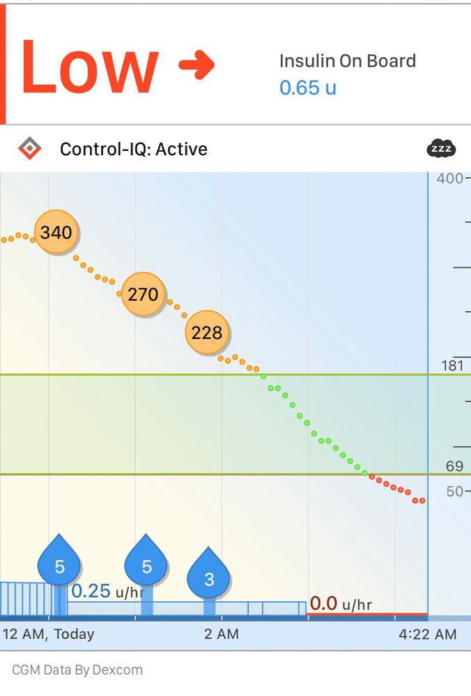 Dexcom blood sugar data that goes from 340 (WICKED HIGH) to LOW 