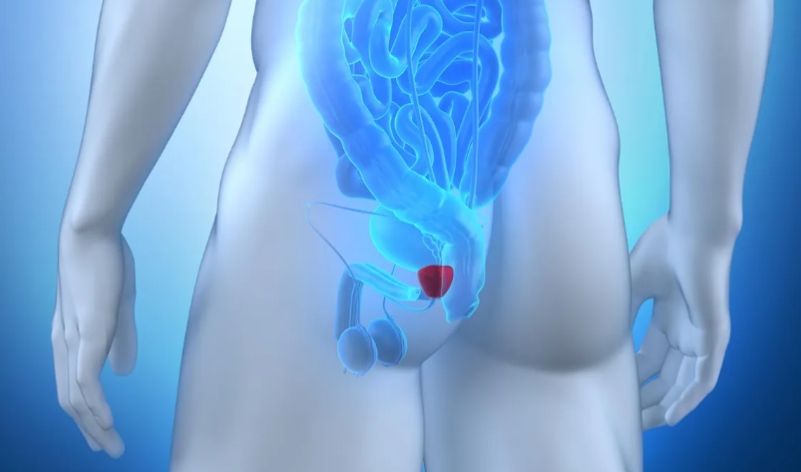 Medizin illustration durchsichtiger mensch alles ist graublau nur die Prostata als kleines arschnahes kügelchen leuchtet rot