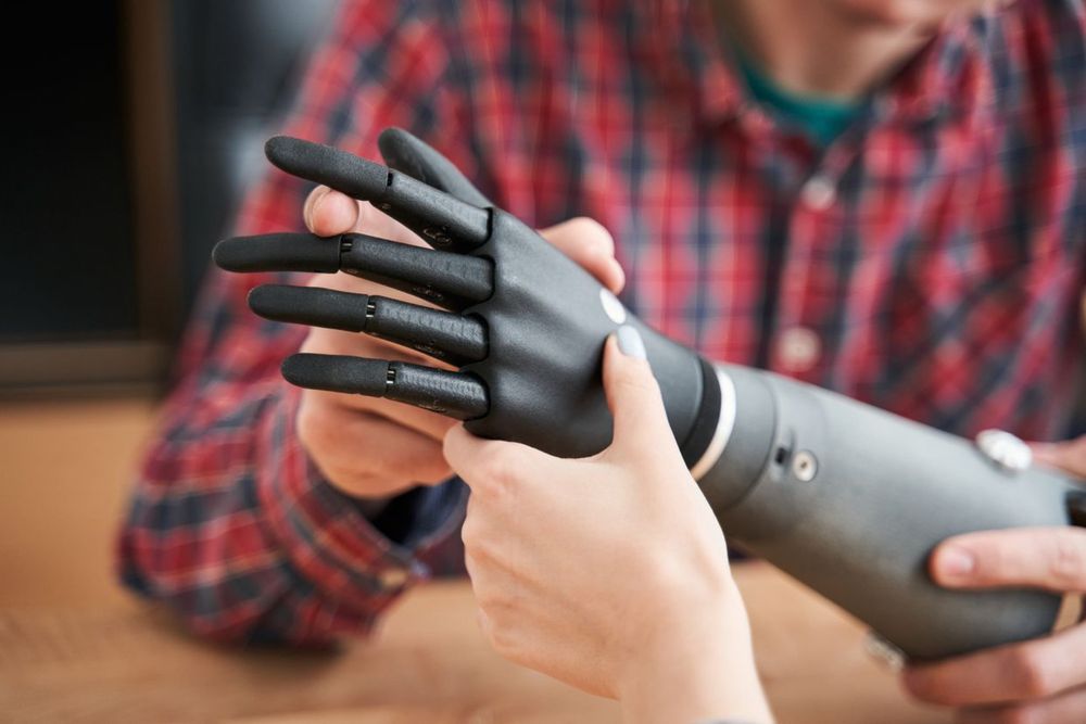 Ukrainian startup Esper Bionics makes cyborgs a reality