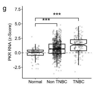 PKR RNA expression in human tumors