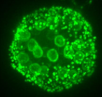 Image of Bd sporangium with actin highlighted in green. Actin forms patches at the cell periphery as well as cages surrounding each nucleus.