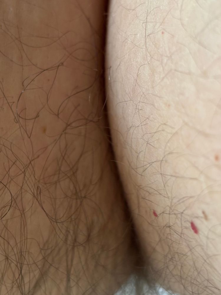 Primer plano de una zona de piel con vello y un pliegue central, creando una ilusión óptica que puede recordar distintas partes del cuerpo.