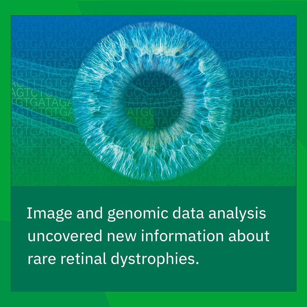 Eye with genomic data and optical coherence tomography (OCT) image in the background.

Image and genomic data analysis uncovered new information about rare retinal dystrophies. 