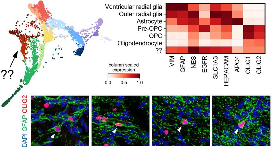 Identification of a cell type with mixed glial markers.