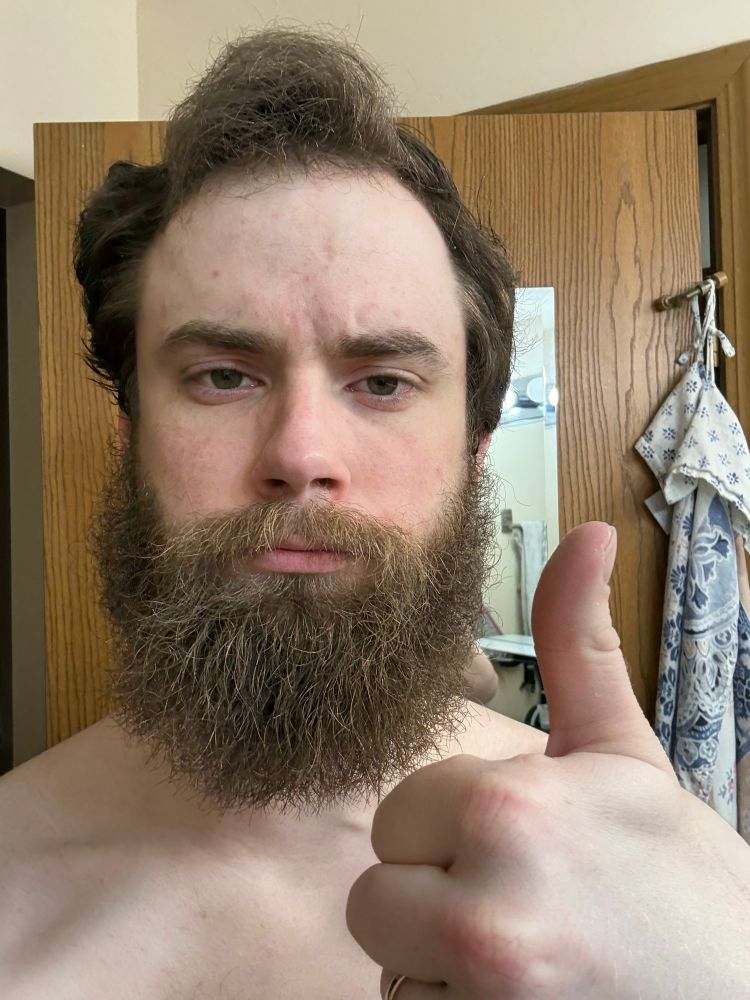Bearded white man with a fading hairline and a thick beard giving a thumbs up with his left hand 