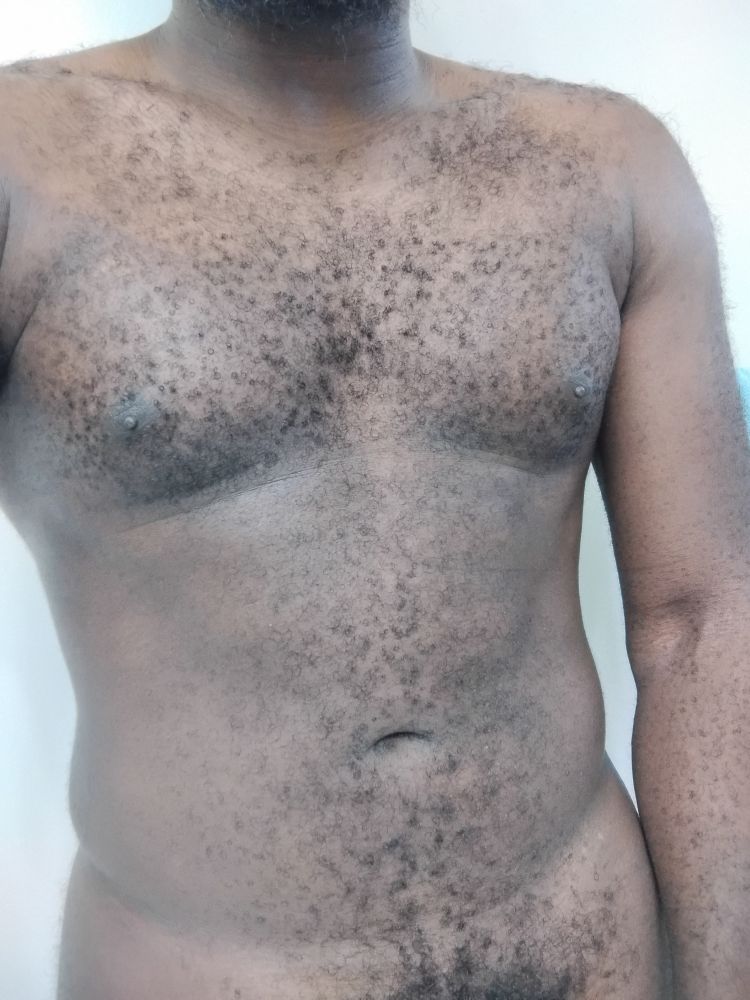 Nude shot of my hairy torso