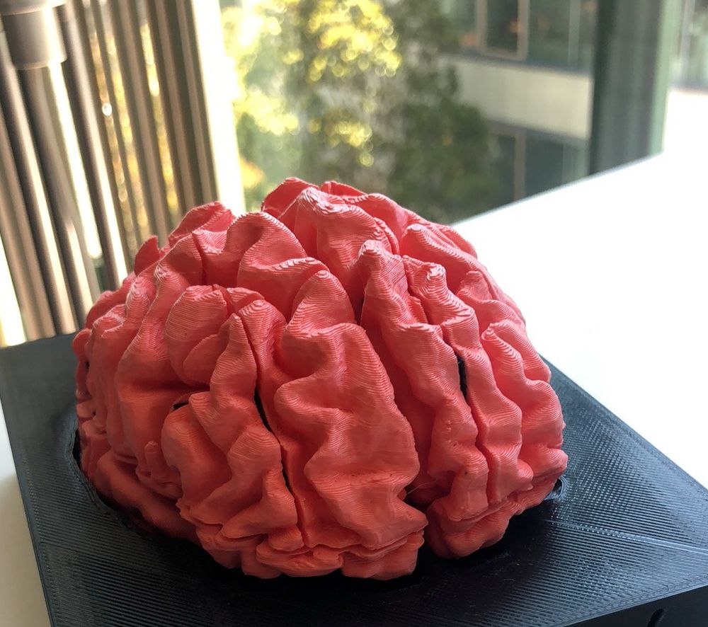 A 3D print of a brain colored pink that is within a black frame.