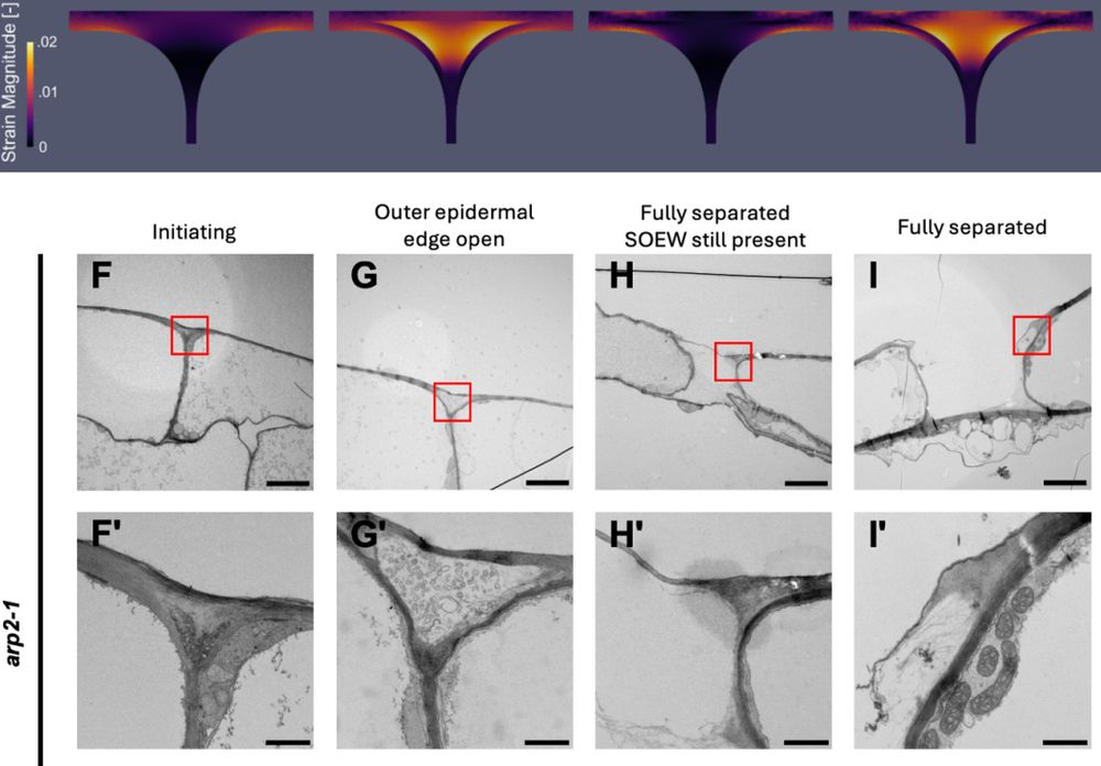 FEM and TEM reveal the process by which cell separation may initiate in the outer epidermal edge filling (OEEF) and propagate to the supracellular outer epidermal wall FEM and TEM reveal the process by which cell separation may initiate in the outer epidermal edge filling (OEEF) and propagate to the supracellular outer epidermal wall (SOEW).
CC-BY-NC-ND 4.0 International license.
(which was not certified by peer review) is the author/funder, who has granted bioRxiv a license to display the preprint in perpetuity. It is
bioRxiv preprint doi: https://doi.org/10.1101/2025.04.03.646819; this version posted April 6, 2025.