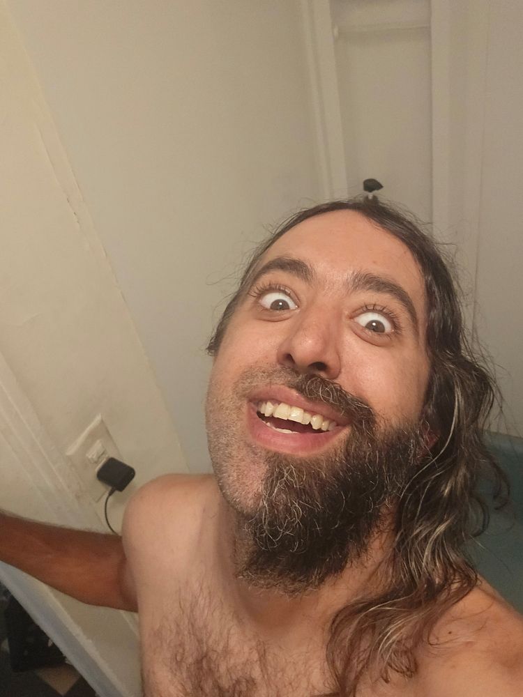 Me with half my face shaved smiling maniacally into the camera.