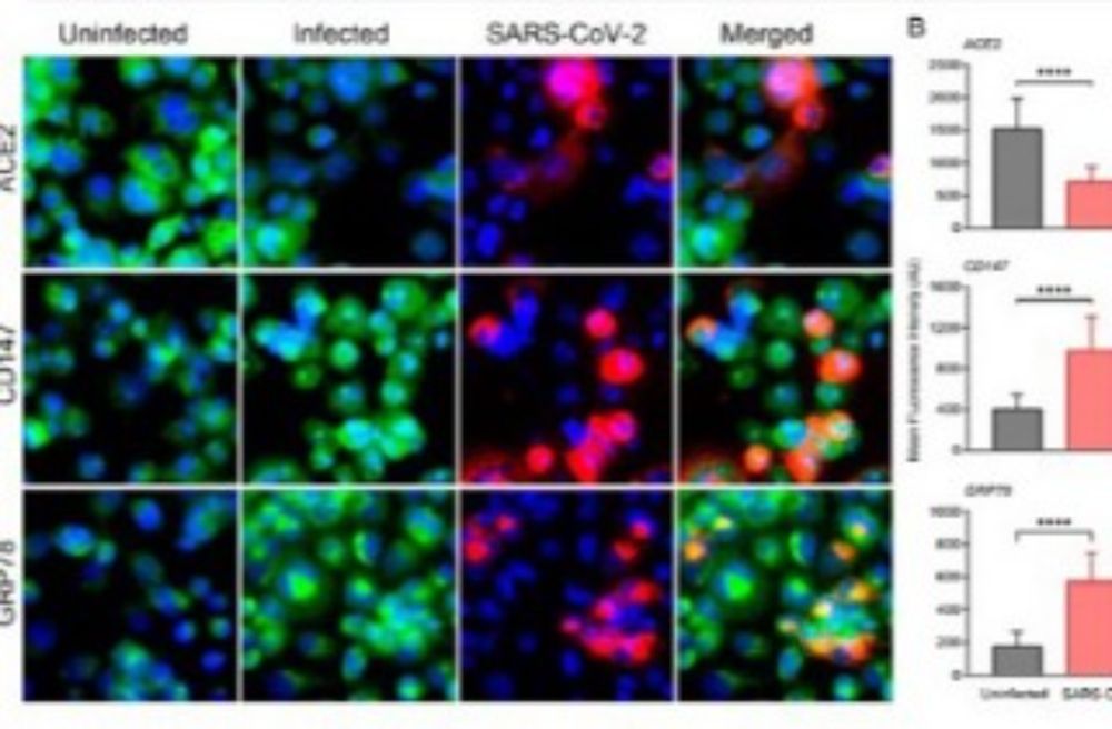 Modulations Of Homeostatic ACE2, CD147, GRP78 Pathways In Pulmonary SARS-CoV-2 Infection - Thailand Medical News