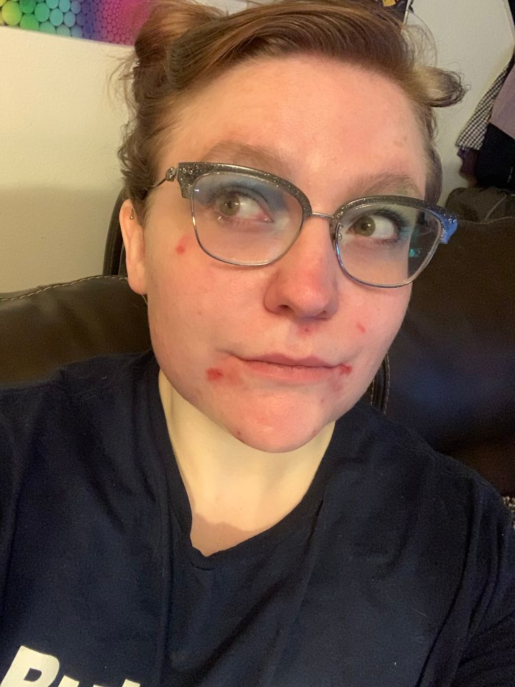 A selfie of TRRG with blemishes on their face, looking off to the side. They have their hair up and blue eyeshadow on one eye and green eyeshadow on the other eye. 