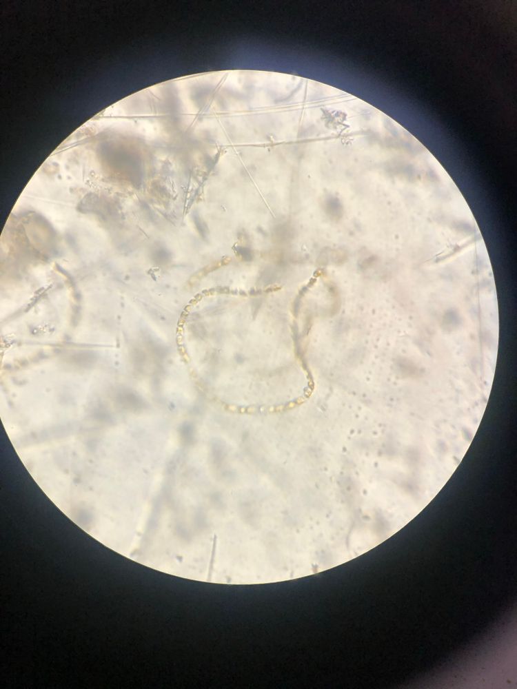 Blurry photo taken through the ocular lens of an inverted microscope. A chain of Chaetoceros socialis diatoms are visible in the center of the frame