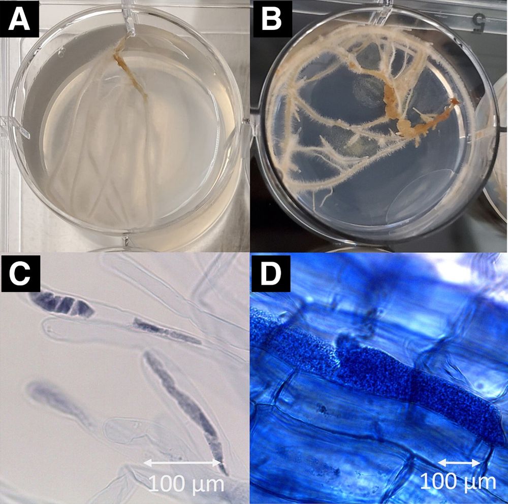 Infection of Spongospora subterranea f. sp. subterranea (Sss) in a hairy root culture system. A, Healthy potato hairy roots 21 days after induction with Rhizobium rhizogenes. B, Formation of gall-like structures on hairy roots. C, Sss sporangia stained with trypan blue observed in root hairs 4 weeks post-inoculation. D, Sss sporangia stained with trypan blue observed in the cortex of hairy roots 8 weeks post-inoculation. 