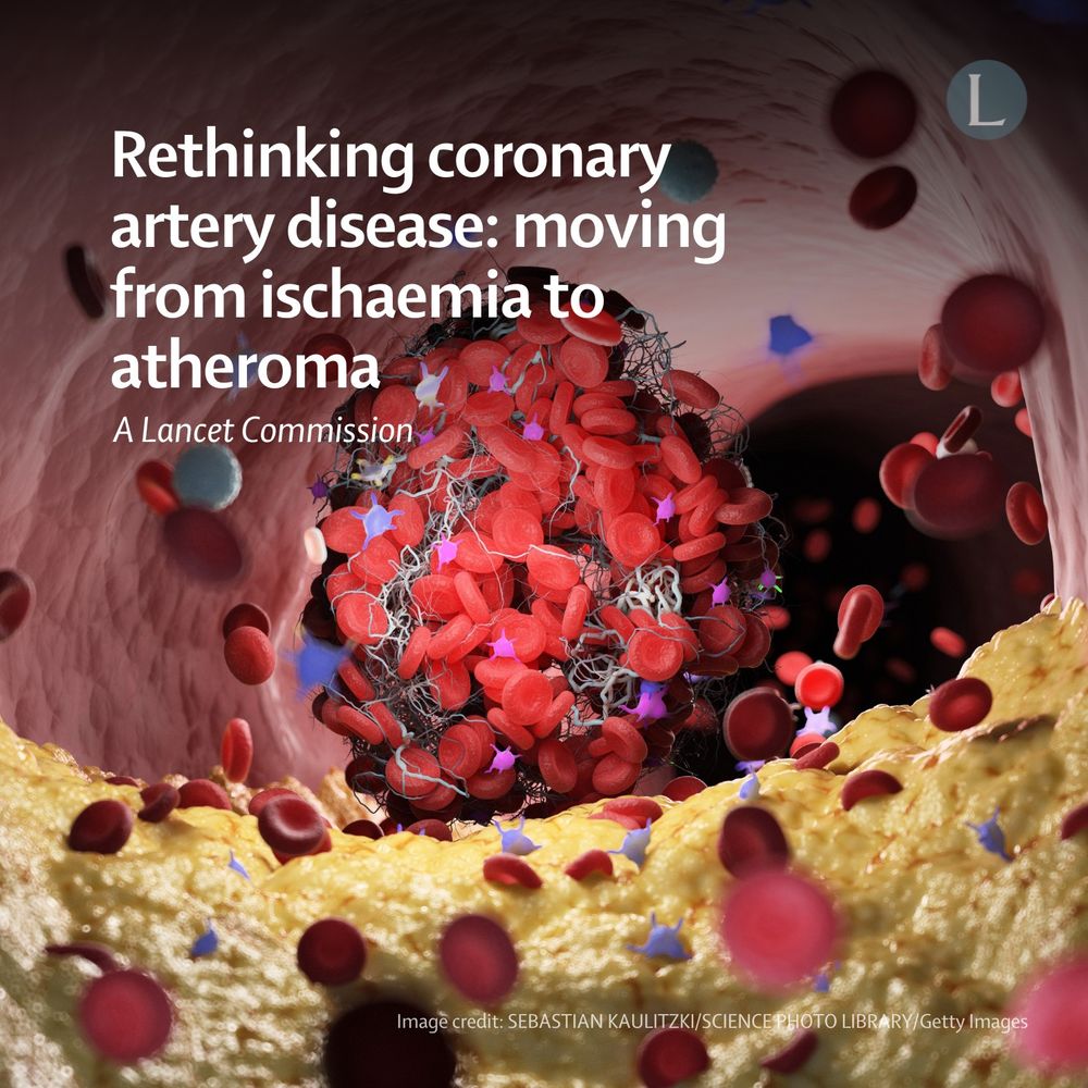 Promotional card for the Lancet Commission on rethinking coronary artery disease: moving from ischaemia to atheroma. Background image depicts a blood clot.