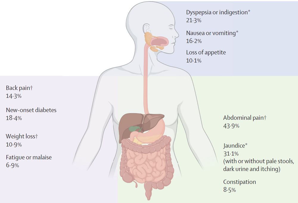 Figure showing most common symptoms and signs of pancreatic cancer at diagnosis. Copyright: Elsevier Ltd. All rights are reserved, including those for text and data mining, AI training, and similar technologies.