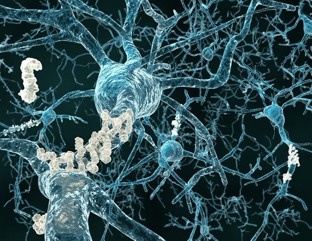 Scientists at The Florey have developed an mRNA technology approach to target the toxic protein tau, which builds up in patients with Alzheimer's disease and other dementias.