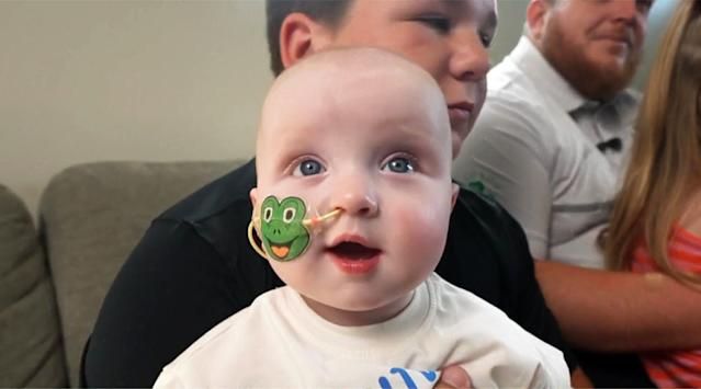 Baby KJ looking alert and healthy