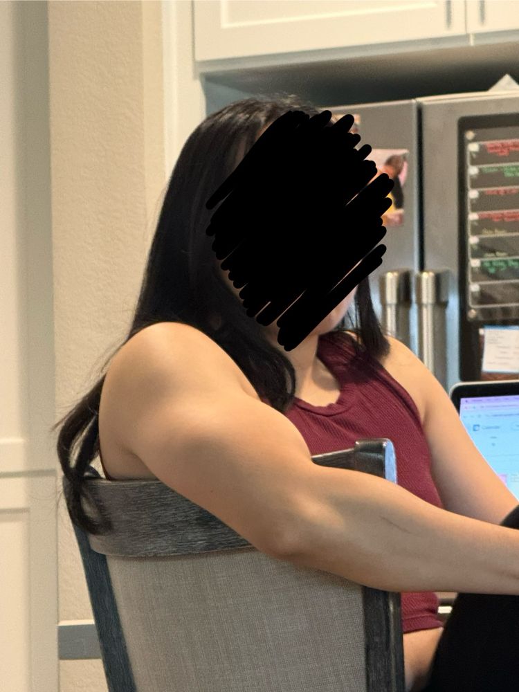 Amy’s muscular right arm