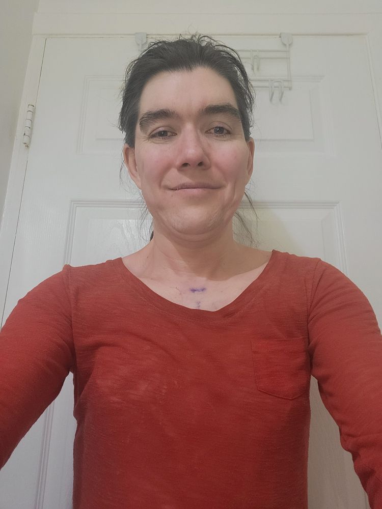 Selfie of a white transgender female with long brown hair up in a ponytail who's waring an orange-red thin slim-fit longsleeve u-nex shirt. Selfie taken approx 16 hours & 30 minutes after she'd breast augmentation. 