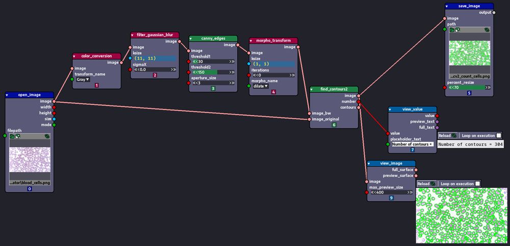 Node graph demonstrating an image loaded depicting blood cells, then having the contours of the cells highlighted and their number counted.