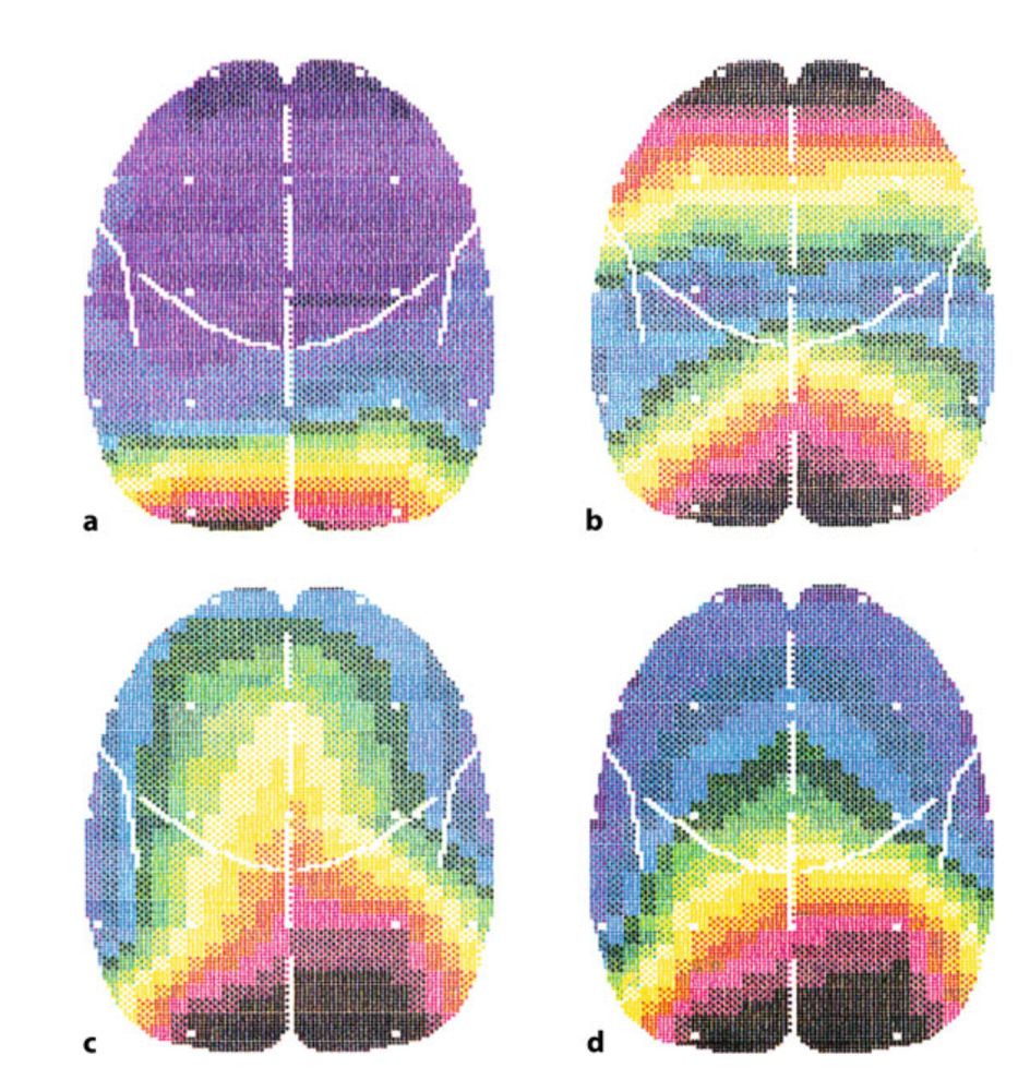 four topoplots showing alpha rhythm distribution, from https://link.springer.com/chapter/10.1007/978-3-662-63267-3_4