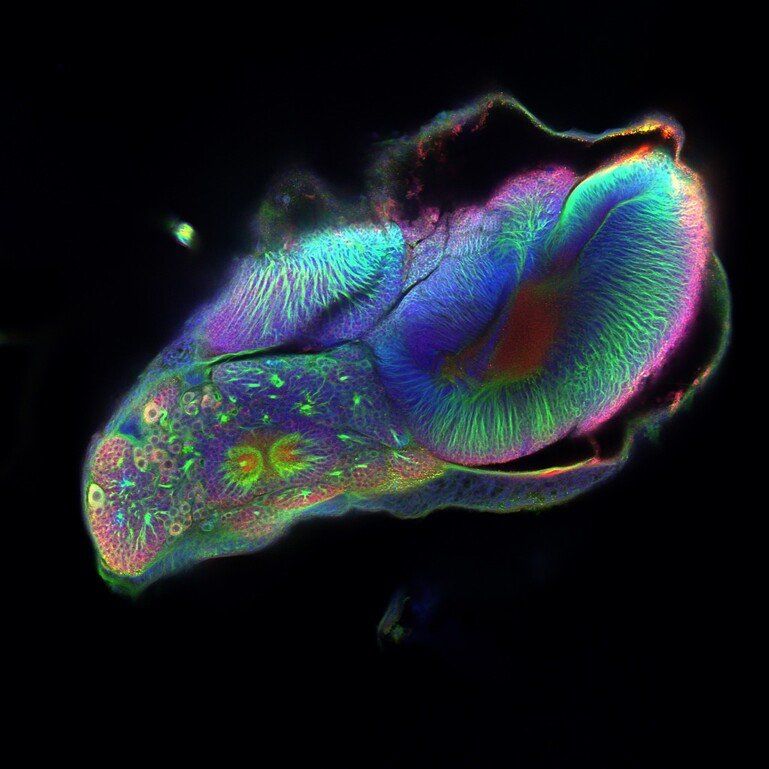 A brightly stained brain caught in metamorphosis, with visible cytoskeletal tracts, large progenitor cells and many smaller cells 